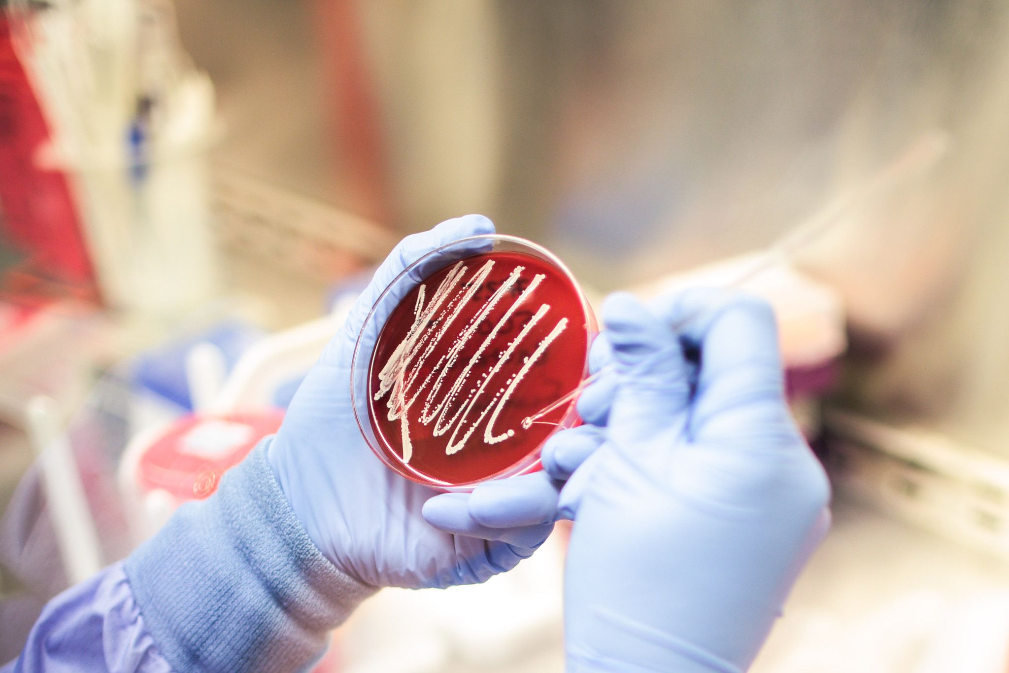 Accugenix® Microbial Identification & Strain Typing